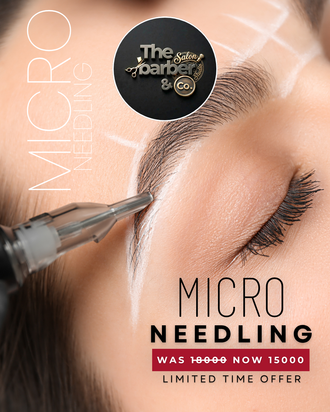 Micro Needling